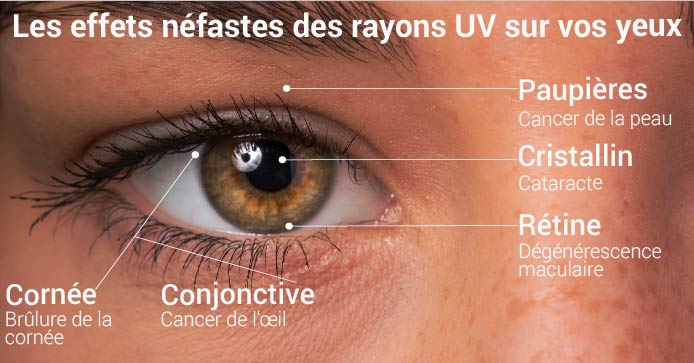 Les effets néfastes des rayons UV sur vos yeux